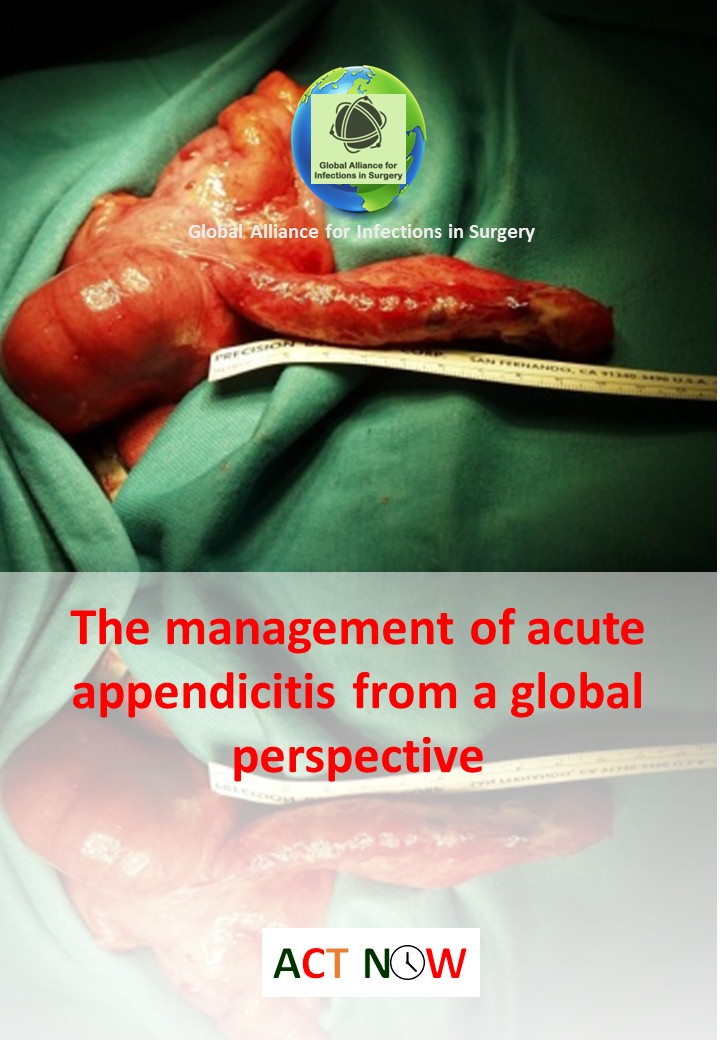 The management of acute appendicitis from a global perspective